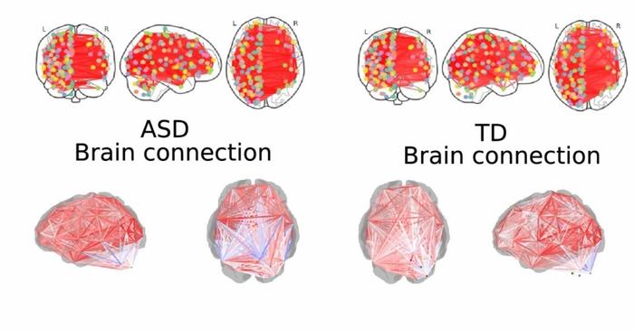 Using of artificial intelligence to diagnose autism spectrum disorder