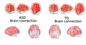 Using of artificial intelligence to diagnose autism spectrum disorder