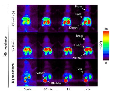 Whole-Body PET Image at 4 Hours after 64CuCl2 Injection