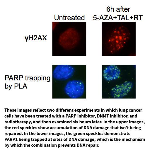 Images of Lung Cancer Cells