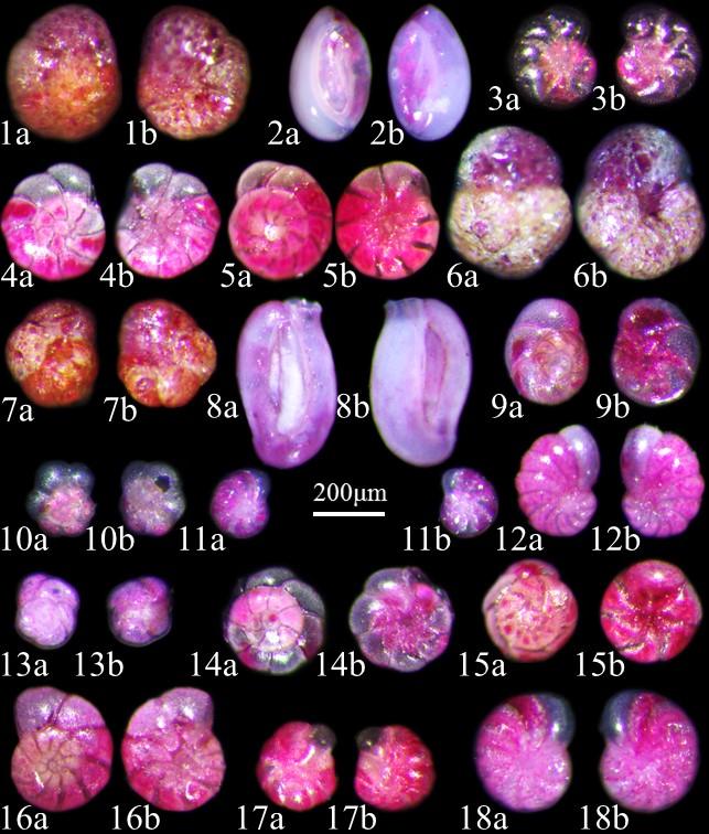 Benthic Foraminifera