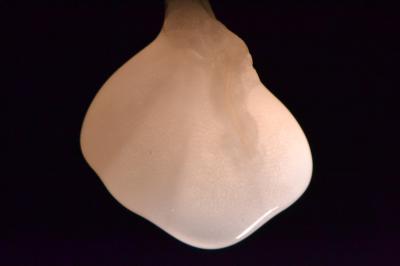 Decellularized Rat Kidney