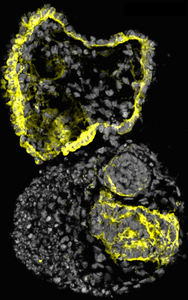 kidney organoid