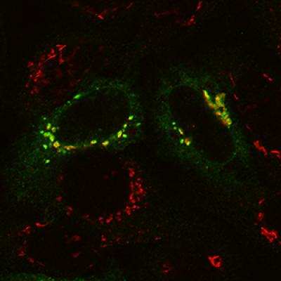 Surprising Culprit Found in Cell Recycling Defect -- Normal Cell