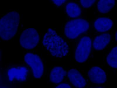 Aneuploidy -- Causes and Consequences (4 of 9)