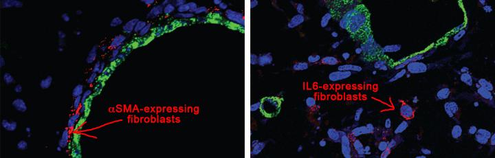 Pancreatic Tumor-Associated Fibroblasts