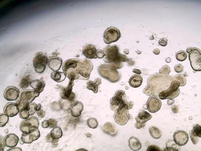 Organoids -- Miniature Versions of Human Intestinal Lining