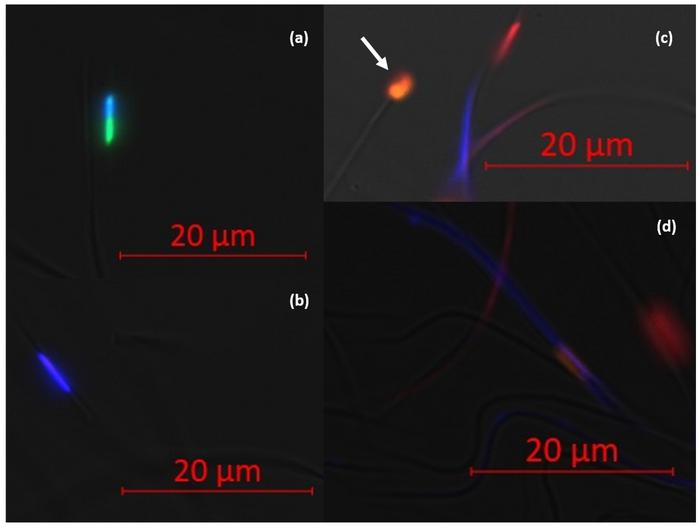 Fluorescence Microscopy Imaging of Spermatozoa