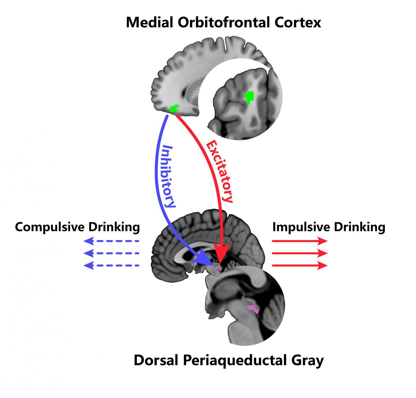The Medial Orbitofrontal Cortex