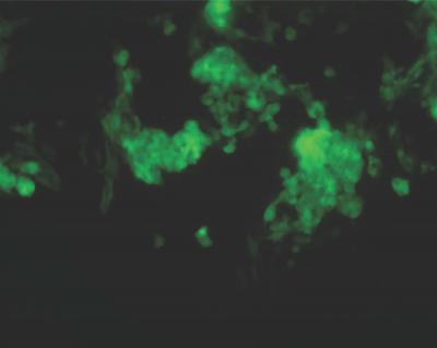 Stem Cell-Derived Cardiomyocytes