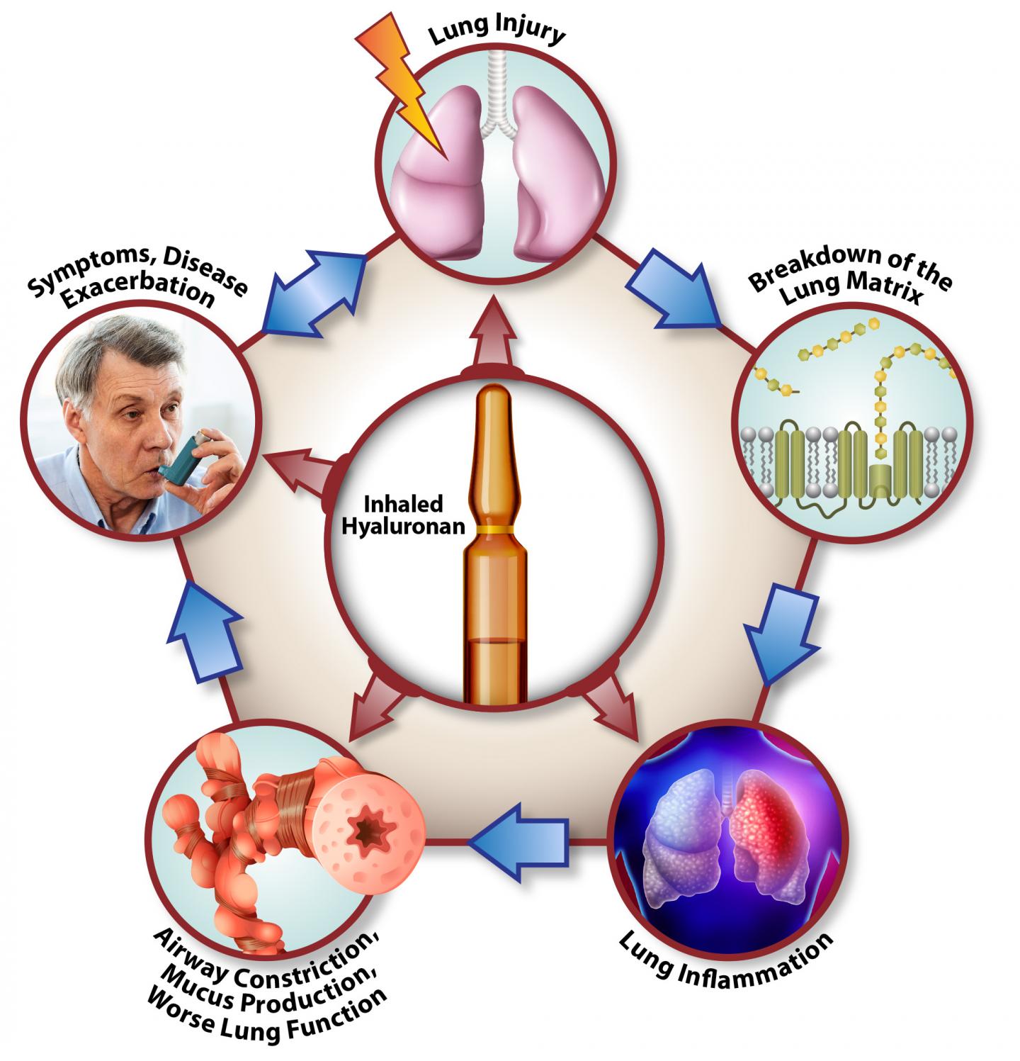 How Inhaled Hyaluronan Affects the COPD cycle