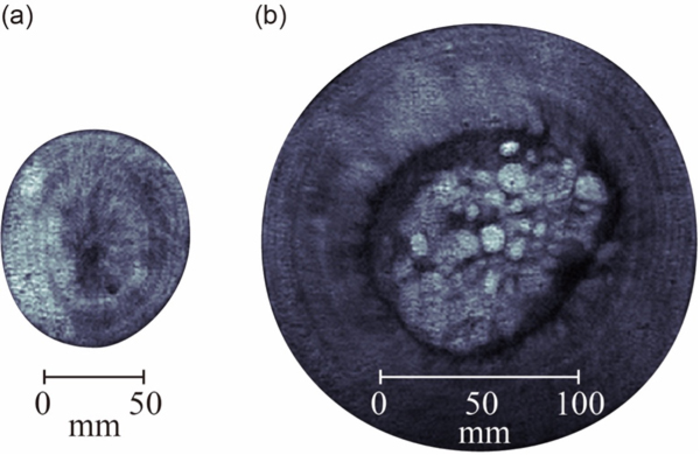 Figure 2. The band-like structures visible on the MRI images are marimo age rings