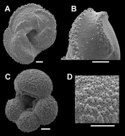 A Micrograph of 2 types of Foraminifera