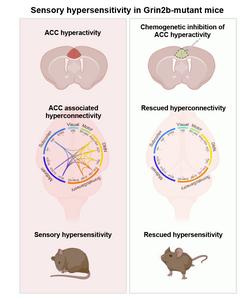 Brain mechanisms underlying sensory hypersens | EurekAlert!