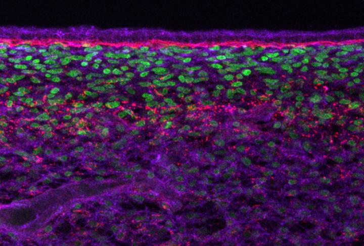 Cross Section through Chicken Skin