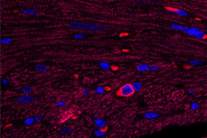 Scientists ID Source of Damaging Inflammation After Heart Attack