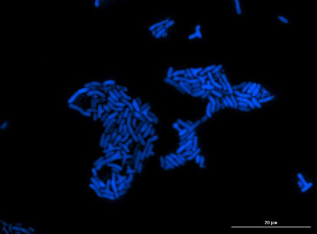 Novel sensor discovered that helps bacteria detect and respond to formaldehyde