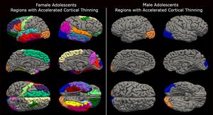 COVID-19 lockdowns and teenage brains