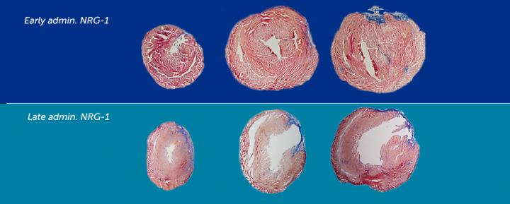 Sample Sections of Mouse Heart
