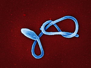 Ebola virus particle