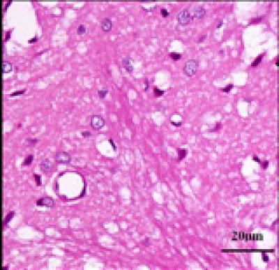 Hematoxylin-Eosin Staining