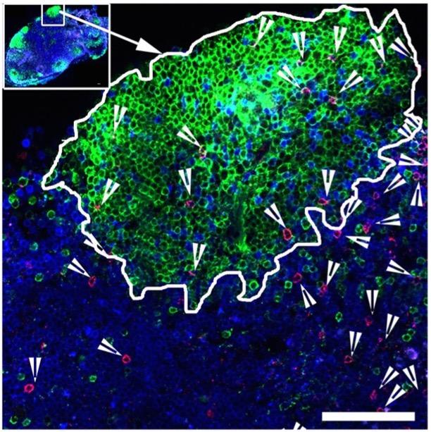 Mesenteric Lymph Nodes