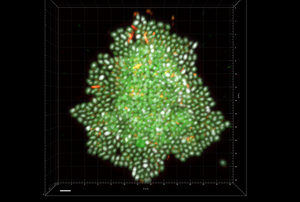 Research Reveals How a Common Bacterium May Spread from the Intestine