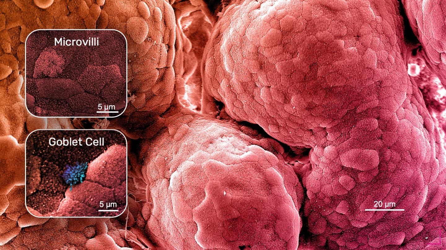 Emulate Intestine-Chip with Microvilli