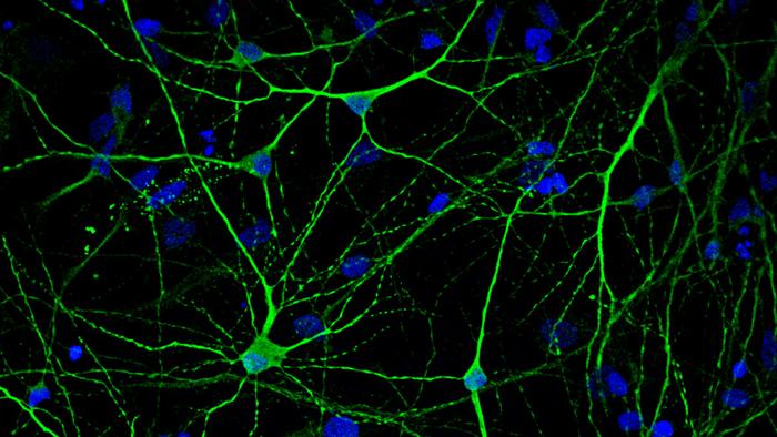 An innovative protocol reveals the distribution of NMDA receptors in the brains of individuals with Alzheimer's