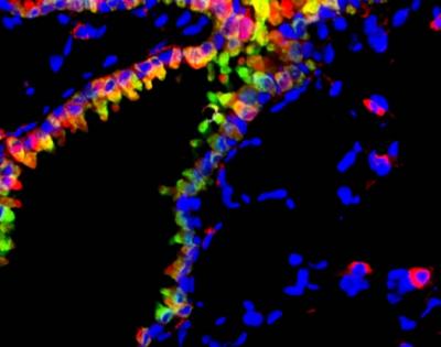 Rebooting the System