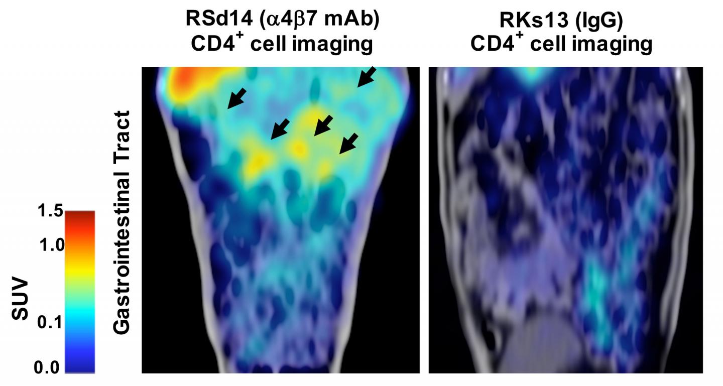 The ART of Combination Therapy Thwarts HIV Infection (1 of 1)