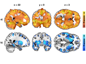 Impact of obesity risk factors on brain function.