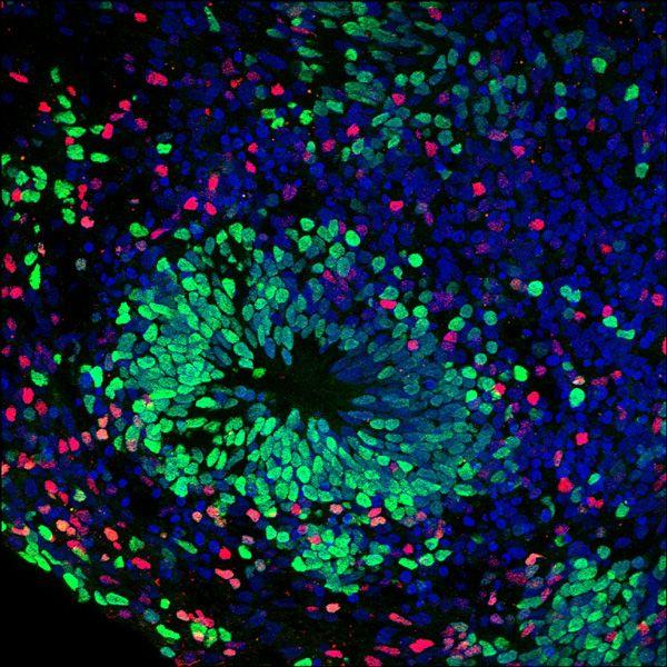 Organoid Layers, UC San Diego School of Medicine