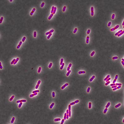 A Chemical that Is Supposed to Kill Bacteria Is Actually Making them Stronger