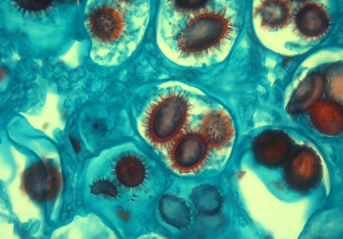 Spores of New Truffle Species