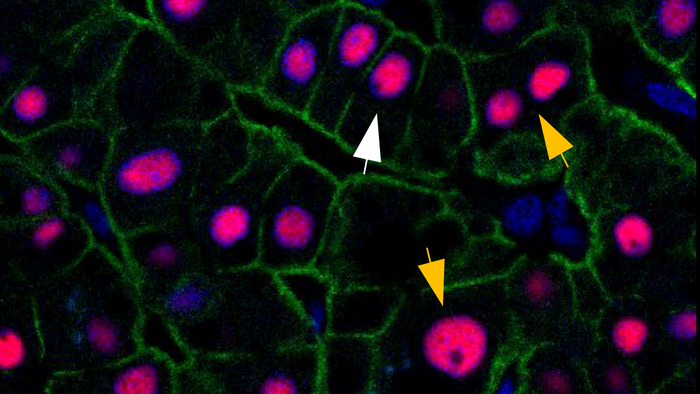 células hepáticas humanas