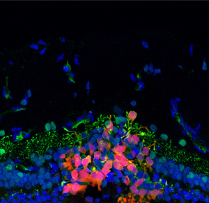 Cell therapy to restore photoreceptors in the retina