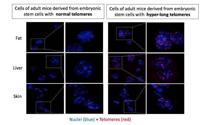 Normal vs Hyper-long Telomeres, CNIO