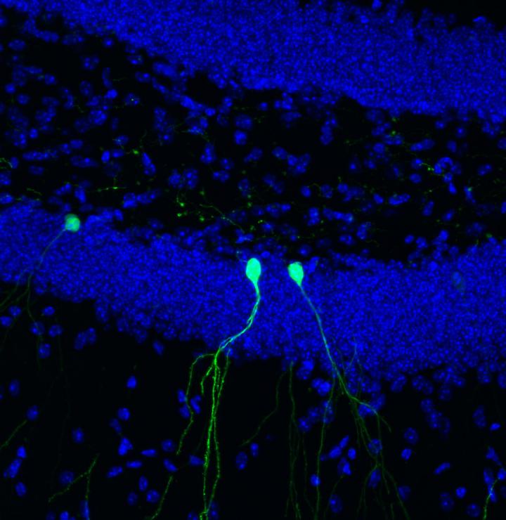 Adult Brain Prunes Branched Connections of New Neurons