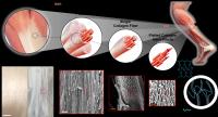 artificial tendon comparison