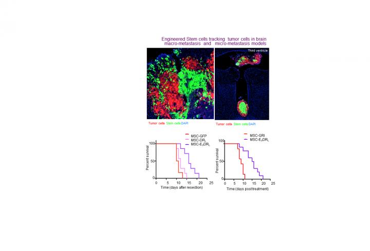 Engineered Stem cells tracking  tumor cells in brain  macro-metastasis  and   micro-metastasis models