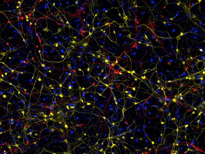 Alzheimer's neurons