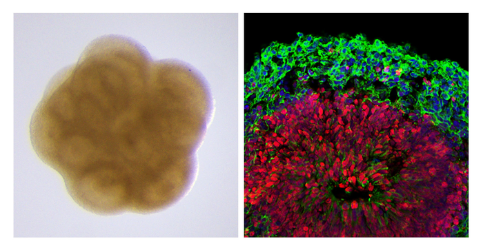 Figure 1A and 1B BO day 50
