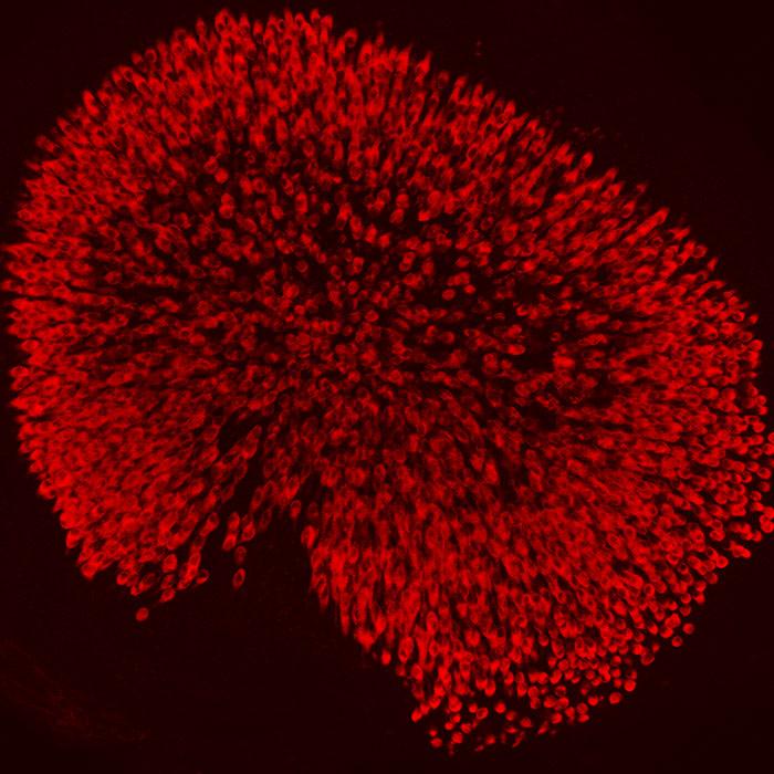 A Kidney-Shaped Organ