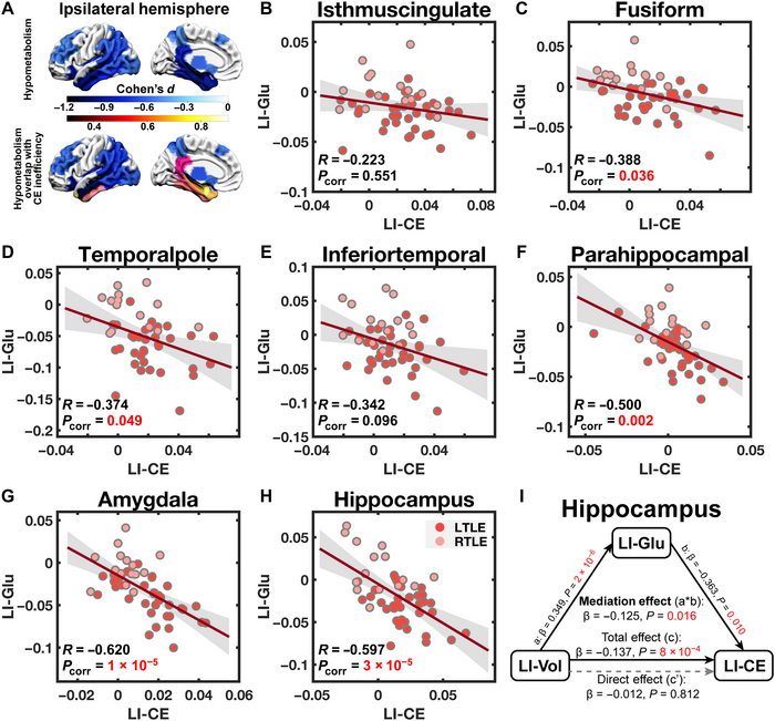 Uncovering the biological basis of control energy: Structural and metabolic correlates of energy inefficiency in temporal lobe epilepsy