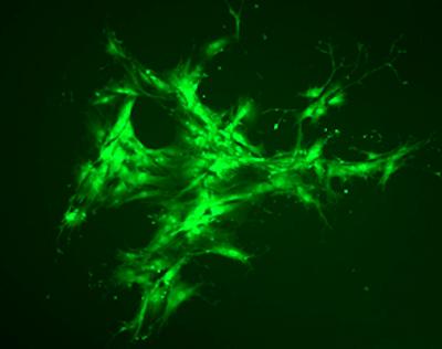 An Endothelial Cell Colony