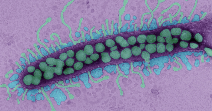 Phages attacking a bacterium