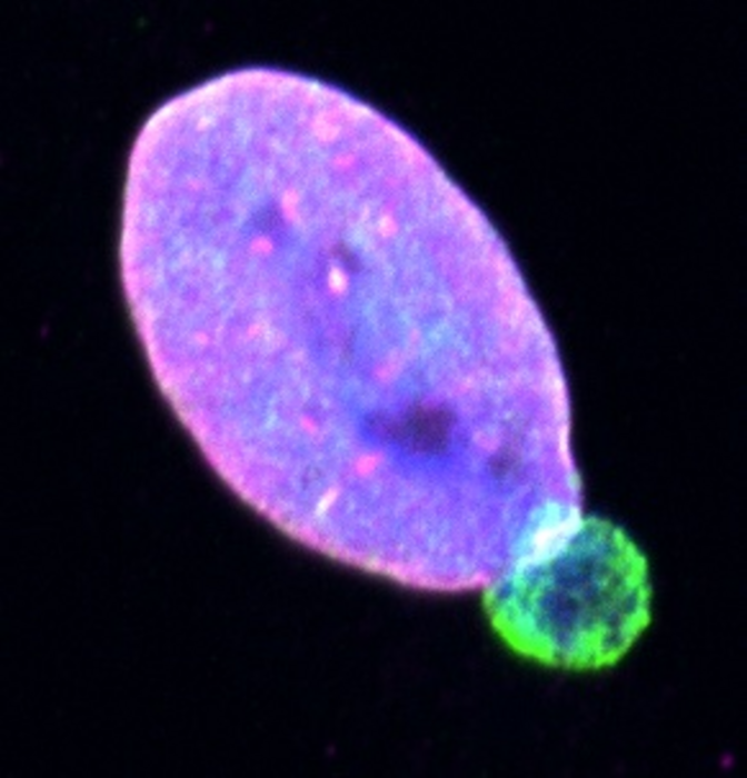 Image 1. Nuclear envelope blebs in melanoma cells.