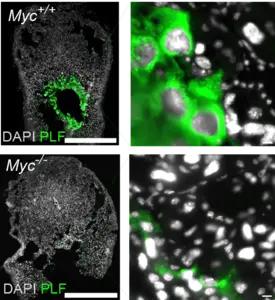 Mouse trophoblast giant cells (green) at nine days post conception for normal mice (top) and for mice with Myc mutation (bottom) that disrupts polyploidy.