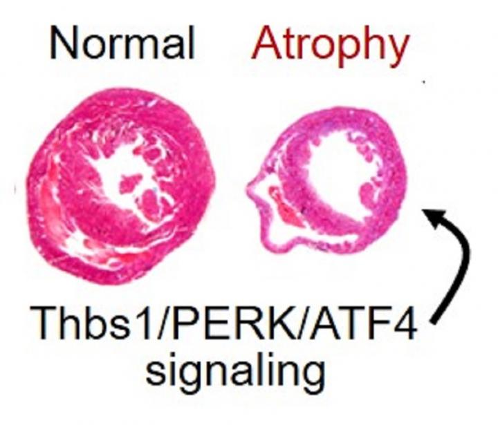 New Understanding of Cardiac Atrophy